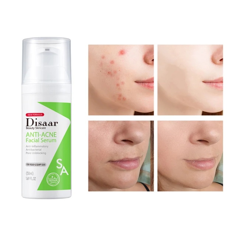 ANTI-ACNE FACIAL SERUM 5 of 7