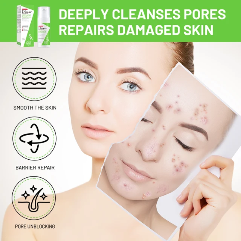 ANTI-ACNE FACIAL SERUM 6 of 7
