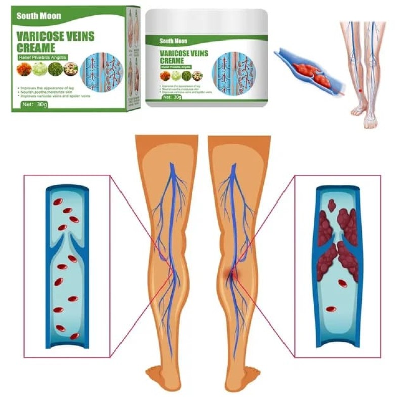 Varicose Veins Cream 4 of 4