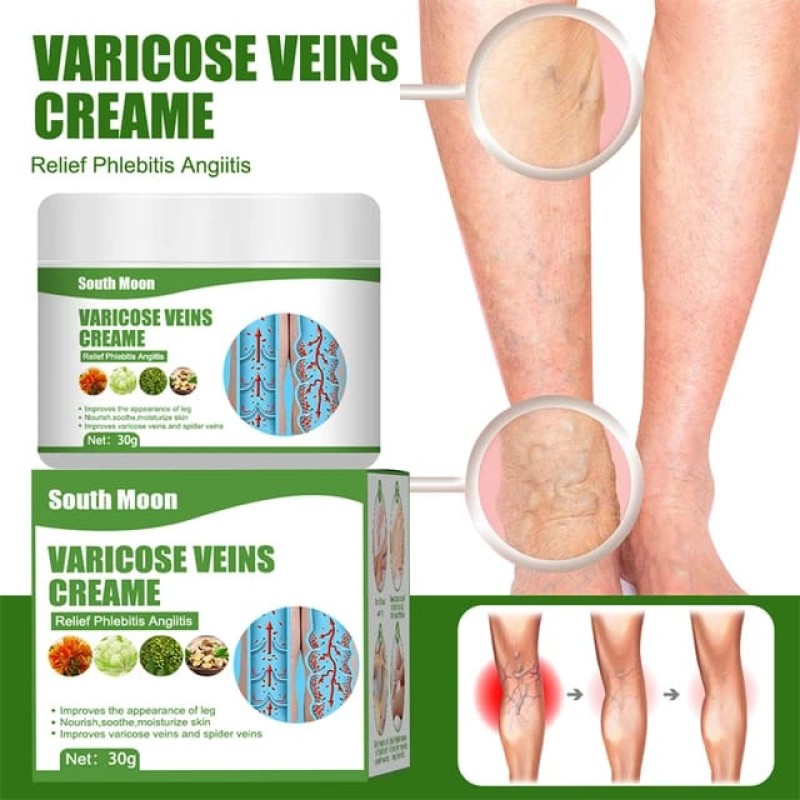 Varicose Veins Cream 3 of 4