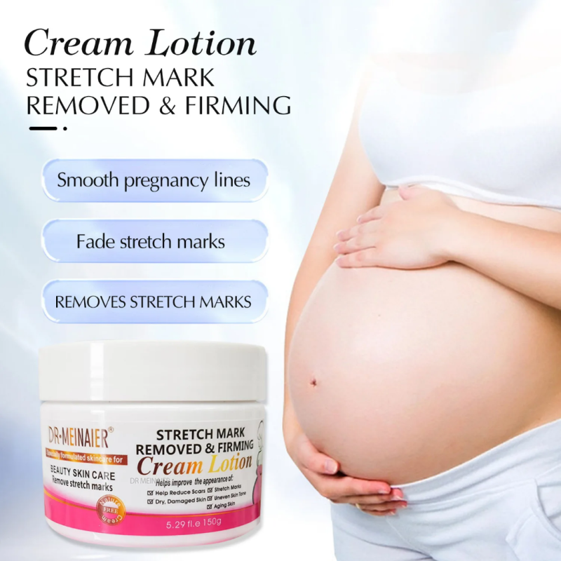 Stretch Mark Removal Cream 3 of 3