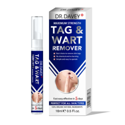Wart Remover Ointment Wart Remover Ointment